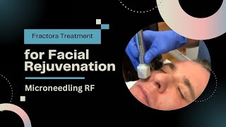 Fractora Treatment for Facial Rejuvenation  Microneedling RF  Dr Jason Emer [upl. by Aduh]