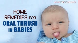 Home Remedies For Oral Thrush In Babies [upl. by Neelik]