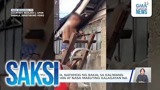 12anyos na bata natuhog ng bakal sa kaliwang braso inoperahan at nasa mabuting  Saksi [upl. by Asiak]