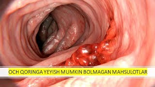 Och Qoringa yeyish mumkin bolmagan mahsulotlar [upl. by Sima]