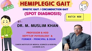 NS17Hemiplegic Gait  Spot DiagnosisFeaturesTypesSites of Lesion of HemiplegiaDr Muslim Khan [upl. by Parish106]