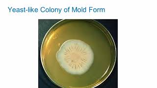 Dimorphic Fungi Sporothrichosis Hot Topic [upl. by Angelle]