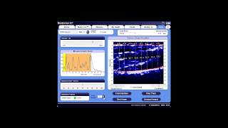 BodyMetrix Pro Training Tutorials For PC Scan Feature Part 1 [upl. by Tergram]