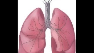 BREATH SOUNDS Stages of Fluid Overload Pneumonia [upl. by Derry83]