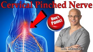 How to Overcome Cervical Pinched Nerve amp Radiculopathy Dont Panic  Dr Alan Mandell DC [upl. by Sira]