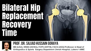 bilateral hip replacement recovery time How long does it take to walk normally after hip replacement [upl. by Crystie]