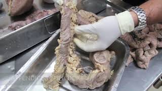 Anatomy Dissection of Large amp Small Intestine [upl. by Tertia589]