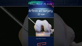 Arthrex acl surgery shorts shortsfeed trending viralvideo ytshorts biology science 3d [upl. by Kcirdneked]