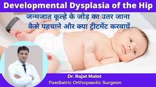 Congenital Hip Dislocation जन्मजात कूल्हे के जोड़ का उतर जाना Developmental Dysplasia of the Hip [upl. by Svetlana]