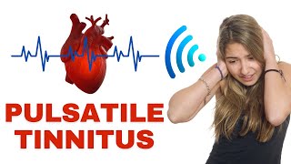 Pulsatile Tinnitus  Why You Shouldnt Ignore It [upl. by Nabetse]