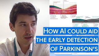 Parkinson’s detected in the eye seven years before presentation [upl. by Traweek562]