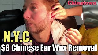 💈 8 CHINESE EAR WAX REMOVAL in NEW YORK CITYs CHINATOWN ear cleaning amp ear picking [upl. by Ursola481]