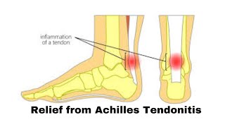 Relief from Achilles Tendonitis [upl. by Zinck159]