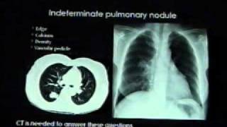 Chestx  ray reading Dr  Mamdouh Mahfouz [upl. by Airrej374]