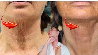 Big massage tutorial for the Neck and DECOLLETTE AREA  Turkey neck  Sagging neck [upl. by Slocum]