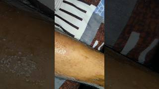 hot wax hair removal [upl. by Brittne]