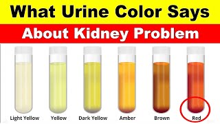 What Urine Color Says About Your Health  Understanding Urine Color and Its Causes [upl. by Sherrard]