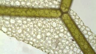 Hydrodictyon a netlike green alga [upl. by Bobbye]