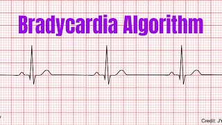 Bradycardia Algorithm [upl. by Nyliahs]