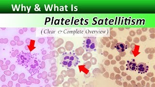 What is Platelets Satellitism   Increase Your Identification Skills [upl. by Acnoib]