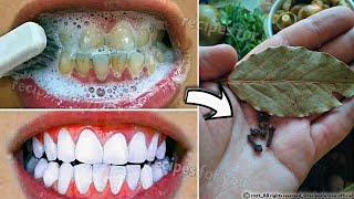 Secret that Dentists dont want you to know Remove Tartar and Teeth Whitening in just 2 minutes [upl. by Loggia573]