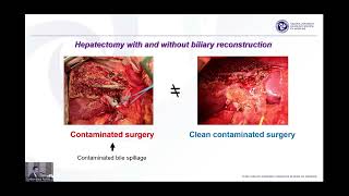 Postoperative Complication and Management [upl. by Watters]