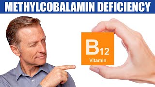 The 1st Sign of a Methylcobalamin B12 Deficiency [upl. by Anauq]