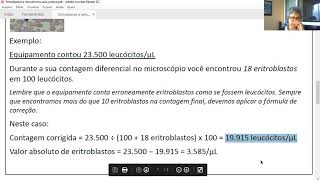 Prática de eritroblastos e reticulócitos [upl. by Gnauq]