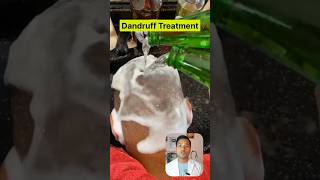 Dandruff treatment at Home  DrAnkit  health shorts [upl. by Nnylyak264]