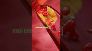 कोलेस्ट्रॉल कैसे बढ़ता है How Cholesterol Affects Your Body Explained with ANIMATIONshorts [upl. by Inaniel786]