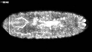 Dorsal closure in Drosophila [upl. by Nalyd440]