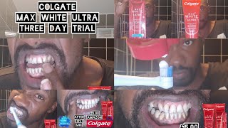 3 DAY TRIAL OF Colgate MAX WHITE ULTRA TOOTHPASTE [upl. by Sharleen]