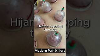 quotStepbyStep Guide to Hijama Cupping Therapy  Learn the Ancient Healing Techniquequot [upl. by Nhar]