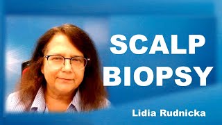 6 Tips on how to make a good scalp biopsy [upl. by Katina753]