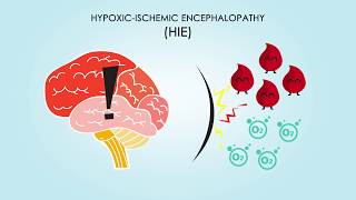 HypoxicIschemic Encephalopathy About Treatments amp Causes [upl. by Whitcomb]