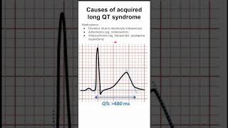 Causes of acquired long QT syndrome [upl. by Harty]