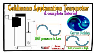 Goldmann Applanation Tonometer  Complete Tutorial [upl. by Masao]