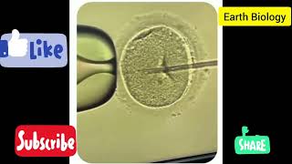 ivfin vitro fertilization icsiziftgift aiDrSupriyaPuranikIVF DrSupriyaPuranikIVF [upl. by Salbu]