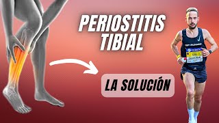 ❌ Descubre Cómo ELIMINAR la PERIOSTITIS TIBIAL FUNCIONA ✅ [upl. by Letsyrhc]