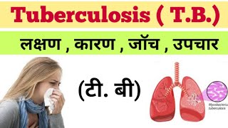 टीबी Tuberculosis Infection in hindi  TB ke lakshan  TB ka illaj  TB blood lab test [upl. by Nangem797]