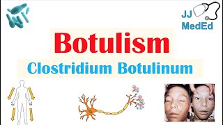 Botulism Clostridium Botulinum Pathogenesis Symptoms Diagnosis Treatment Prevention [upl. by Aihsenal]