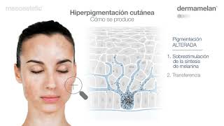 Dermamelan Guía de Uso Español [upl. by Sherborne]
