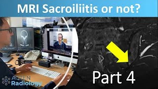 Sacroiliitis or not  with Prof Hermann  Part 4 [upl. by Lesnah588]