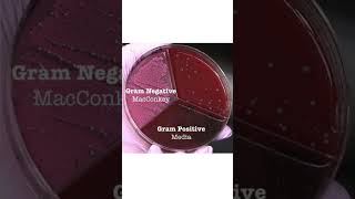 Gram negative bacterial growth on culture media mastitisminute dairyscience dairyindustry cow [upl. by Gower]