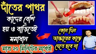 দাঁতের পাথর দূর করার উপায়  how to remove dental tartar  teeth calculas remove Solution💯 [upl. by Remark]