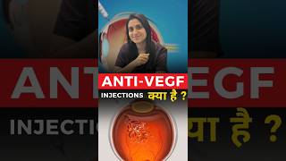 Anti  VEGF Injections क्या है [upl. by Burrows847]