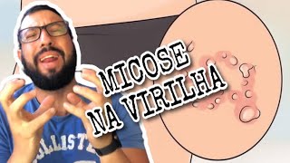 TUDO SOBRE MICOSE DE VIRILHA E COMO SE LIVRAR DELA Me LEANDRO MOSCARDI [upl. by Melamed]