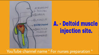 IM INJECTION SITE I INTRAMUSCULAR INJECTION SITE I HOW TO LOCATE INTRAMUSCULAR INJECTION SITES I FNP [upl. by Casilde]