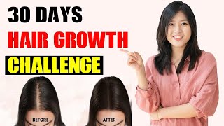 30 Days Challenge How to Transform Thin Hair to Thick Hair Naturally [upl. by Aicemed]