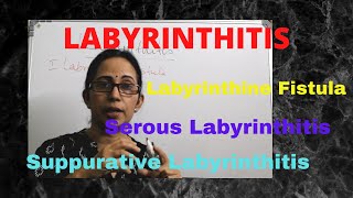 055 Labyrinthitis otitismedia vertigo [upl. by Yr]